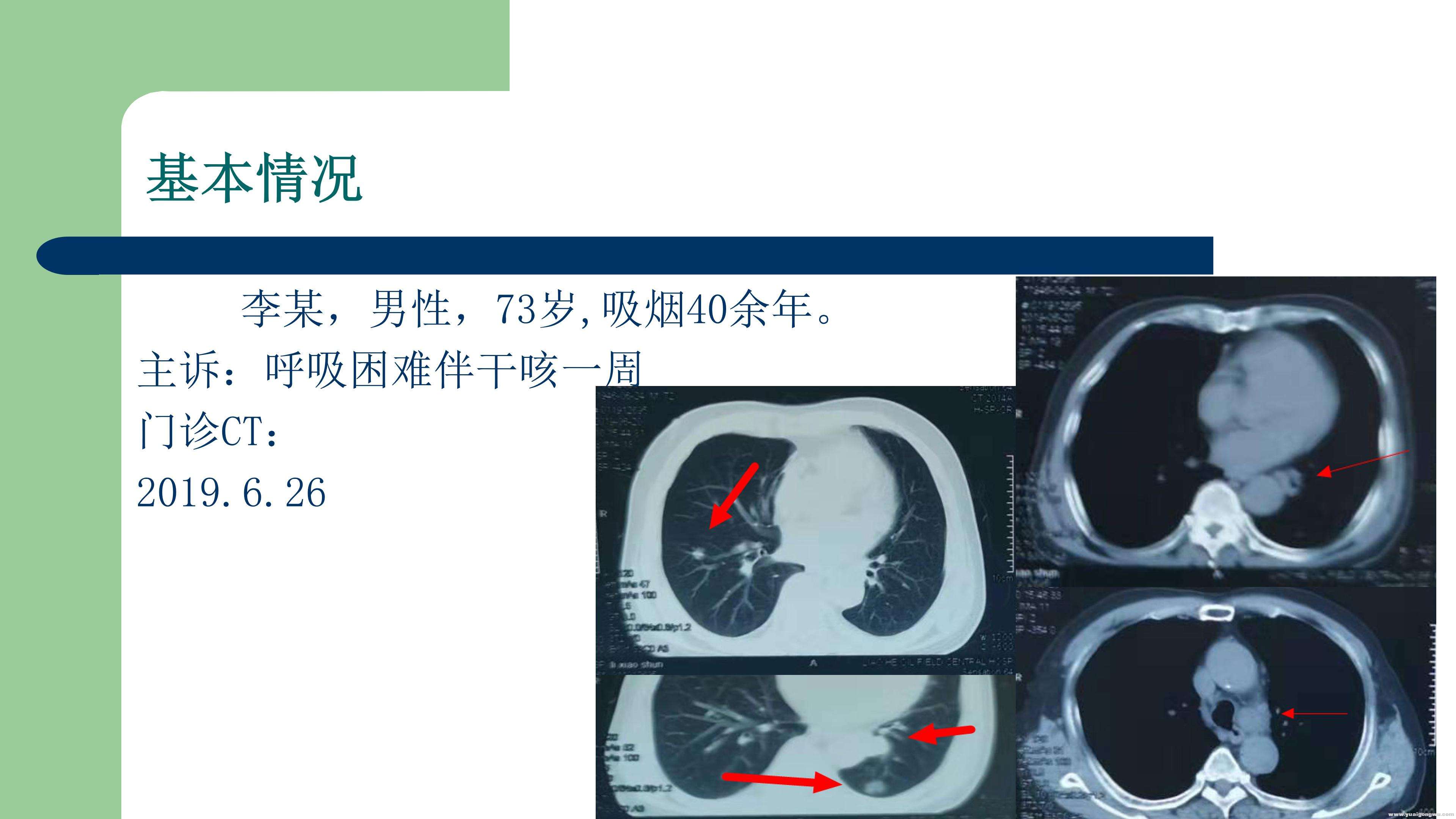 PD1病例分享_02.jpg